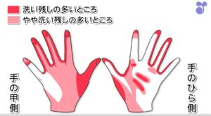 手の洗い残しが多い部分